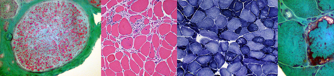 pathology image collage